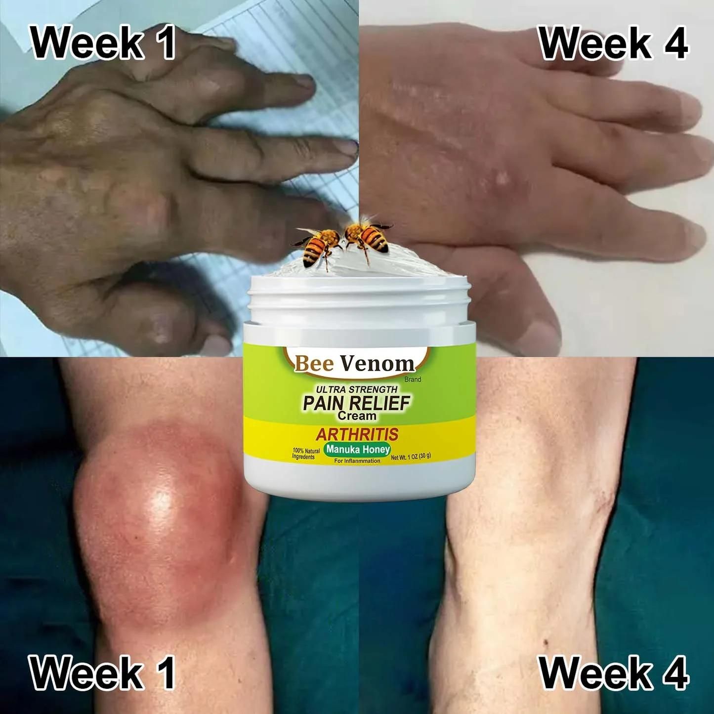 Bee Venom Ultra Strength Bone & Joint Pain Relief Cream 100 gram (Pack of 2)